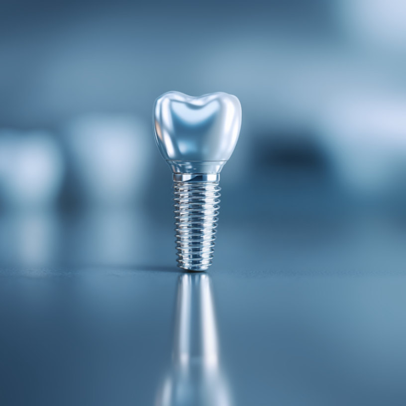 chirurgie implantaire