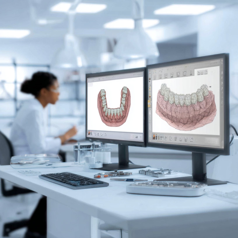 chirurgie mucogingivale
